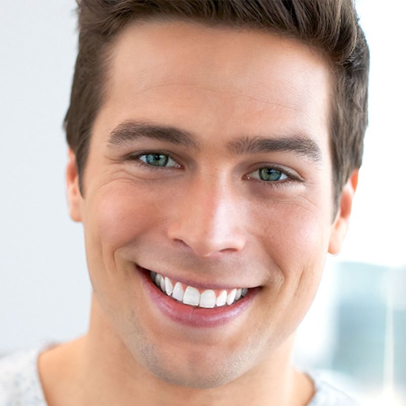 Teeth-Whitening-Newcastle