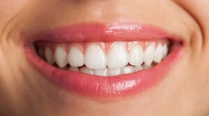 Philips Zoom Whitening