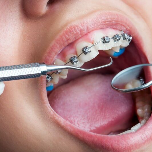 Orthodontics-Image